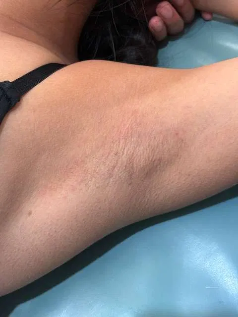 Smooth result after an underarm wax appointment